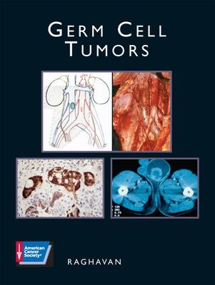 GERM CELL TUMORS